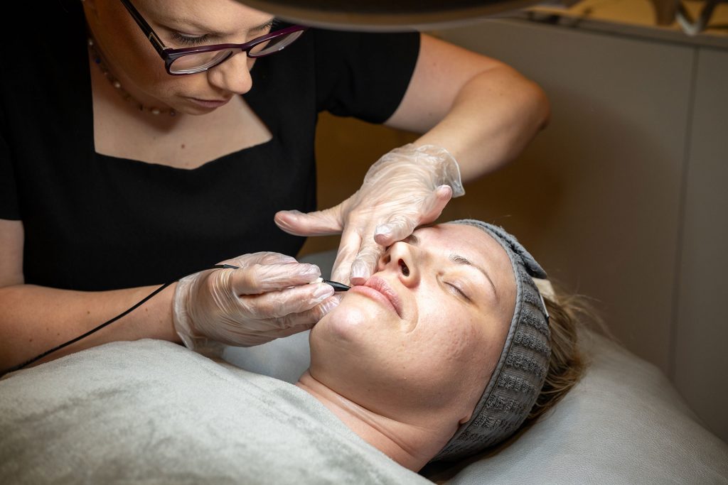 Electrolysis Belfast 1