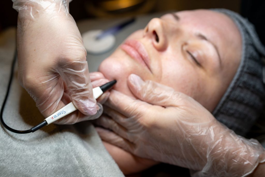 Electrolysis Belfast 2